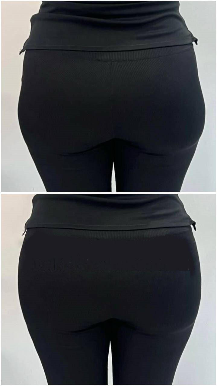 فیلر بادی کرج