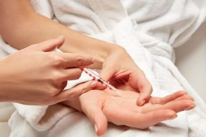 کاربرد بوتاکس در کاهش عرق کف دست