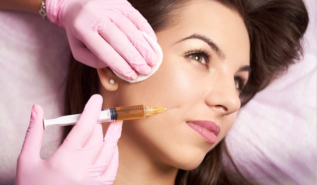فیلر خط خنده چگونه است
