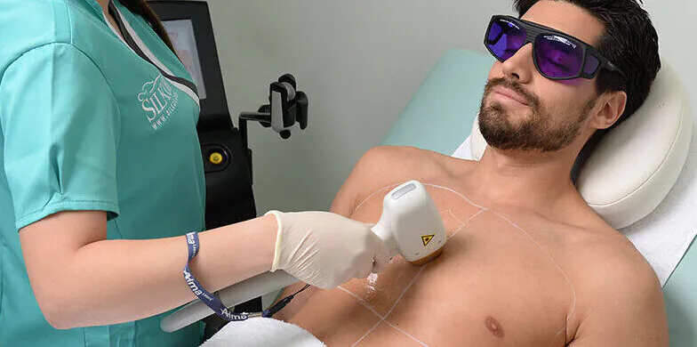 💪 لیزر موهای زائد سینه در آقایان؛ راهی مطمئن برای پوستی صاف و جذاب