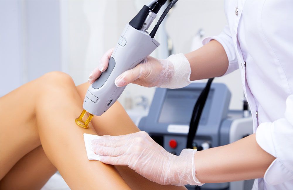 اشتباهات رایج در انجام لیزر موهای زائد و راهکارهای جلوگیری از آن ⚠️