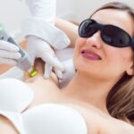 لیزر موهای زائد یا آی‌پی‌ال (IPL)