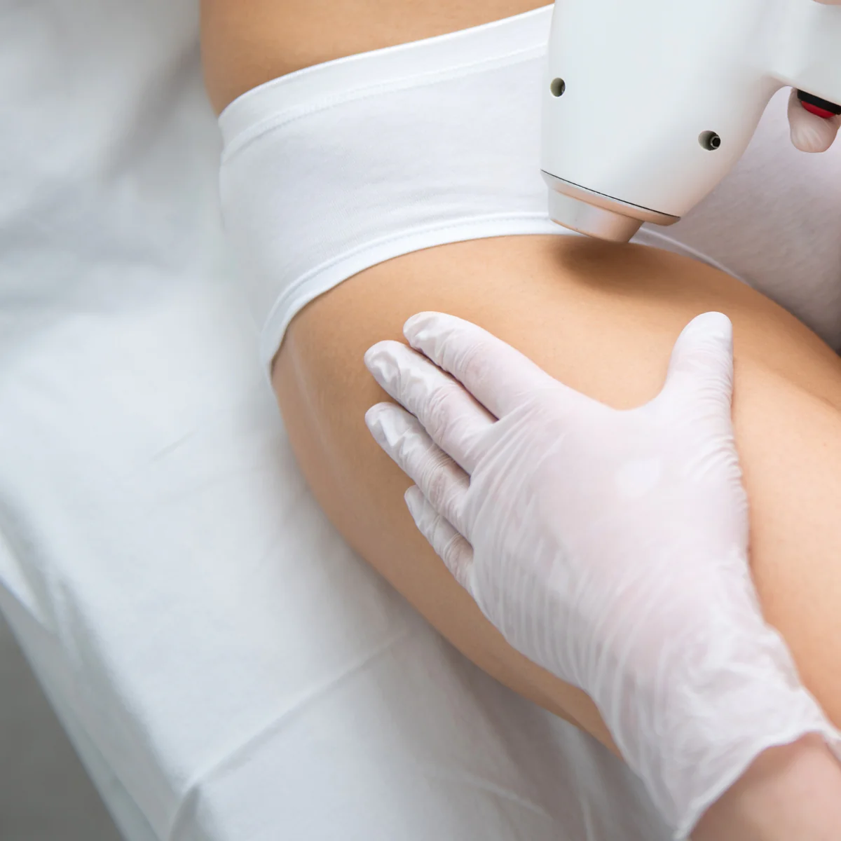 همه چیز در مورد لیزر موی زائد تناسلی 🌸 تجربه‌ای ایمن در کلینیک بلا