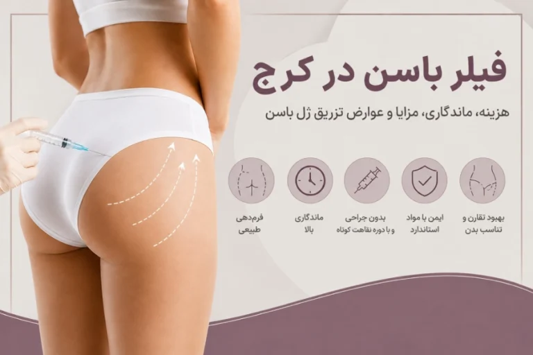 فیلر باسن در کرج