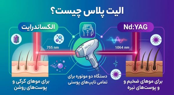 الیت پلاس چیست؟
